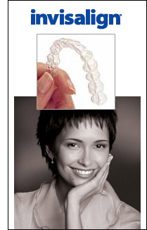 Invisalign Braces